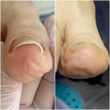 Робота із формою нігтя