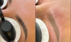 Удаление лазером тату и татуажа Майстер перманентного макіяжу Наталя Харків