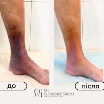 Андрій Дембіцький, Київ Фото - 5