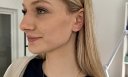 Прокол вух Косметолог-ін'єкціоніст Анна Чернівці