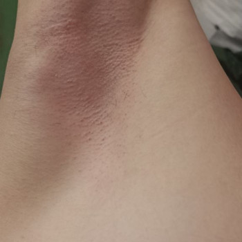 Анюта Шлапак, Тернопіль Фото - 6