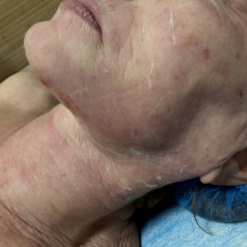 Фото з портфоліо майстра Наталія Чернишина (масажист, Черкаси)