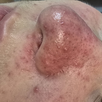 Фото из портфолио косметолога Вікторія Громяк (Ужгород)