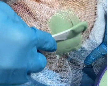 альгінатна маска