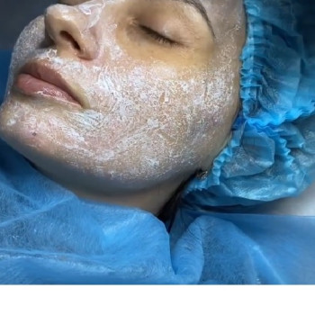 масаж обличчя з маскою