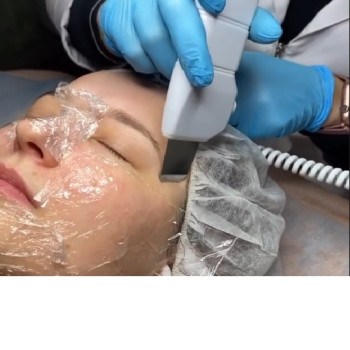 чистка обличчя