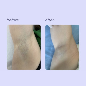 Катерина Толмачова, Киев Фото - 5