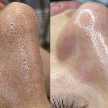 Катерина Толмачова, Киев Фото - 6