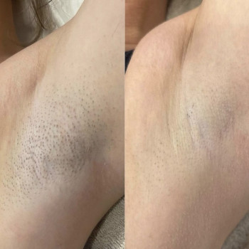 Катерина Толмачова, Киев Фото - 9