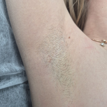 Фото з портфоліо майстра Катерина Маркушевська (майстер епіляції, Кам'янське)