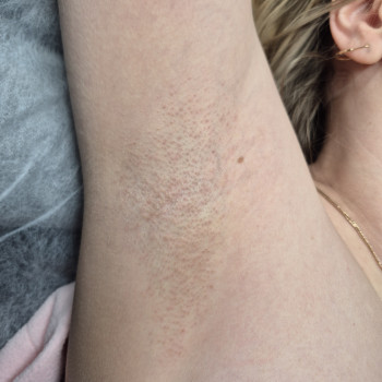 Фото з портфоліо майстра Катерина Маркушевська (майстер епіляції, Кам'янське)