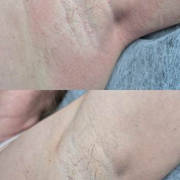 Фото з портфоліо майстра Катерина Маркушевська (майстер епіляції, Кам'янське)