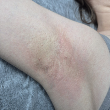 Фото з портфоліо майстра Катерина Маркушевська (майстер епіляції, Кам'янське)