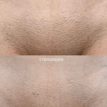 Solar, Софиевская Борщаговка Фото - 5