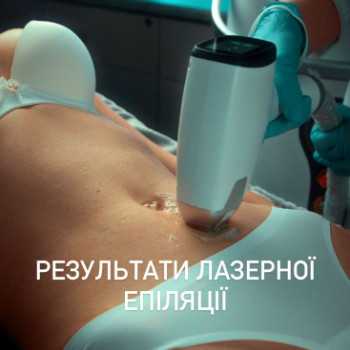 Medicalaser, Київ Фото - 5