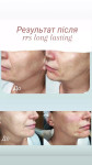 7 точок ліфтингу з RRS long lasting Лікар-косметолог Олеся Тернопіль