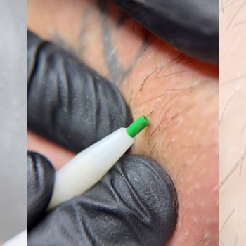 Електроепіляція у нашій студії на Святошино( Київ) проходить у спокійній атмосфері- без поспіху з повагою до кожної клієнтки.