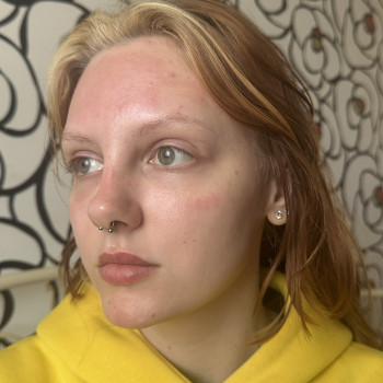 Покращення стану шкіри