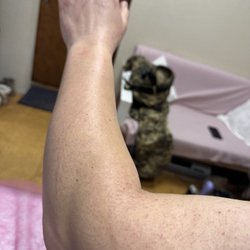 Чоловічадепіляція