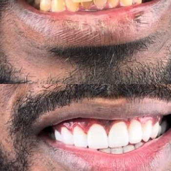 Віталій Ковальов, Київ Фото - 5