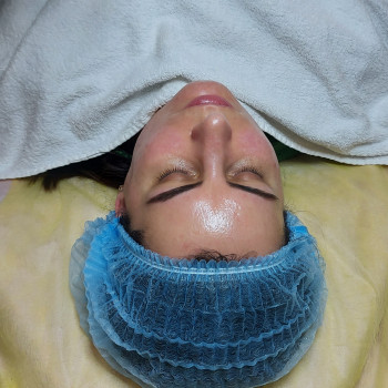 Фото из портфолио косметолога Анастасия Колесник (Харьков)