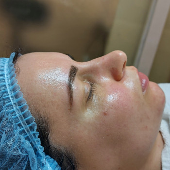 Фото из портфолио косметолога Анастасия Колесник (Харьков)