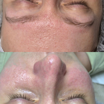 Фото из портфолио косметолога Анастасия Колесник (Харьков)