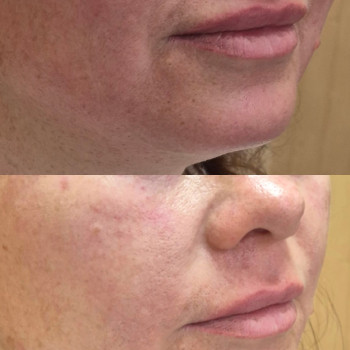 Фото из портфолио косметолога Анастасия Колесник (Харьков)