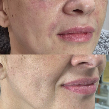 Фото из портфолио косметолога Анастасия Колесник (Харьков)