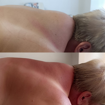 Зменшення холки