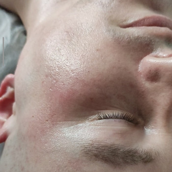 Массаж лица, фото - массажист Oksana Miroshnyk