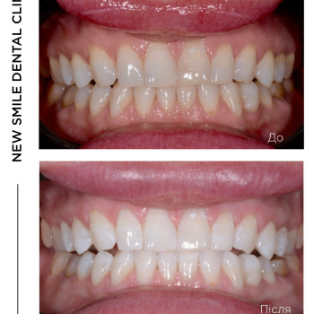Фото с портфолио New Smile
