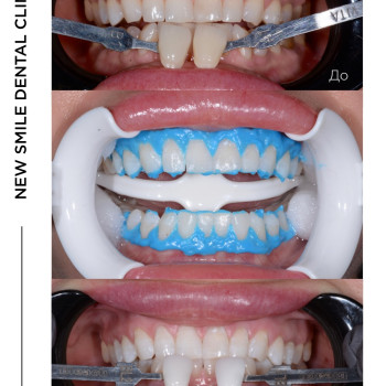 Фото с портфолио New Smile