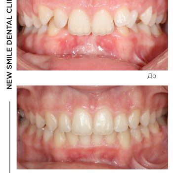 New Smile, Киев Фото - 5