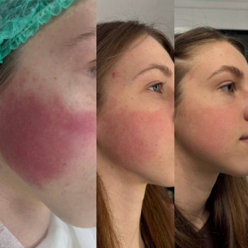 Фото з портфоліо салону KOSMET (салон краси, Житомир)