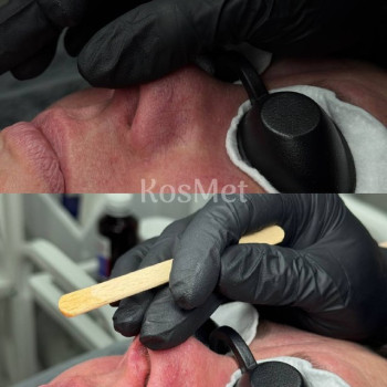 Фото з портфоліо салону KOSMET (салон краси, Житомир)