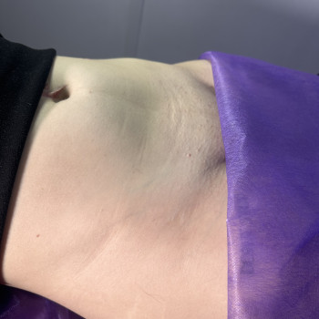 Глибоке бікіні