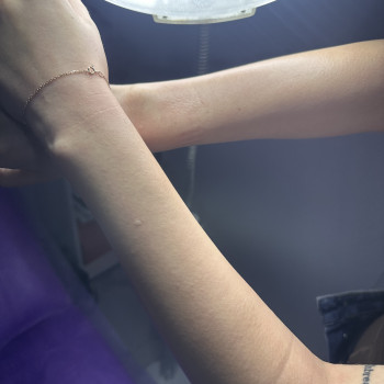 Руки після шугарингк, фото - майстер депіляції Анастасия Бондарева