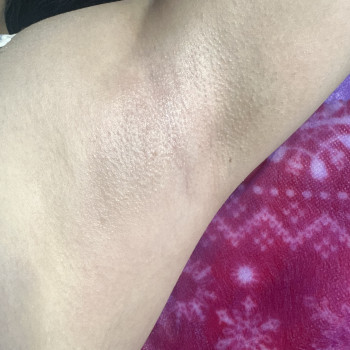 Після, фото - майстер депіляції Анастасия Бондарева