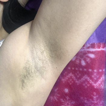 До, фото - майстер депіляції Анастасия Бондарева