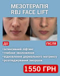 Італійський ліфтинг Rbj FACE LIFT: сяйво та пружність шкіри Косметологический центр WE Cosmetology Киев