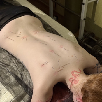 Фото з портфоліо фахівця Дмитро Опарін (кінезітерапевт, Черкаси)