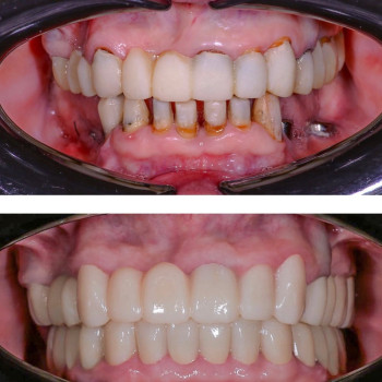 Фото з портфоліо клініки Н+ (стоматологічна клініка, Кам'янське)