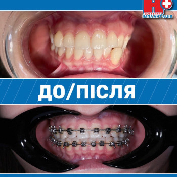 Фото з портфоліо клініки Н+ (стоматологічна клініка, Кам'янське)