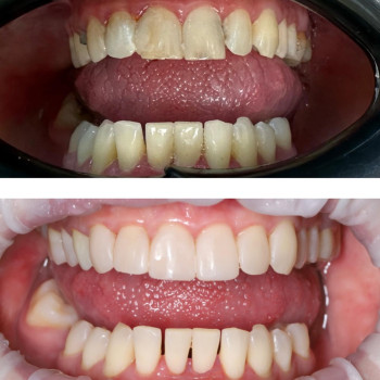 Фото з портфоліо клініки Н+ (стоматологічна клініка, Кам'янське)