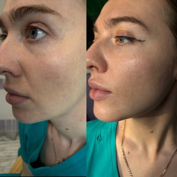 Фото з портфоліо косметолога Ольга Мельник (Біла Церква)