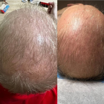 Фото з портфоліо косметолога Ольга Мельник (Біла Церква)