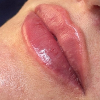 Фото з портфоліо косметолога Ольга Мельник (Біла Церква)