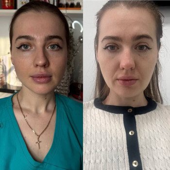 Фото з портфоліо косметолога Ольга Мельник (Біла Церква)