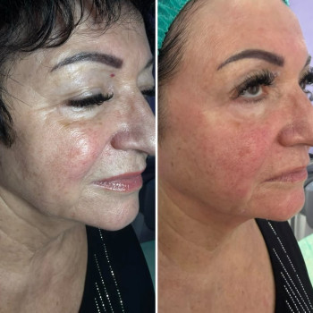 Фото з портфоліо косметолога Ольга Мельник (Біла Церква)